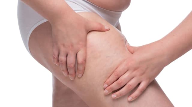 Jakie badania są kluczowe w diagnostyce lipodemii? Sprawdź teraz!